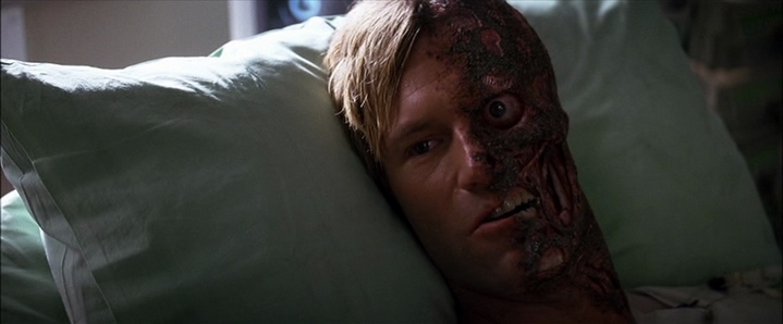 Harvey Dent (Aaron Eckhart) défiguré sur son lit d'hôpital, se métamorphose en Double Face...