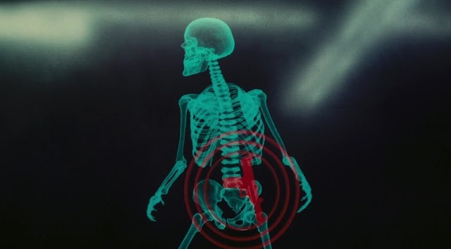 L'arme de Douglas Quaid repérée par rayons X dans Total Recall.